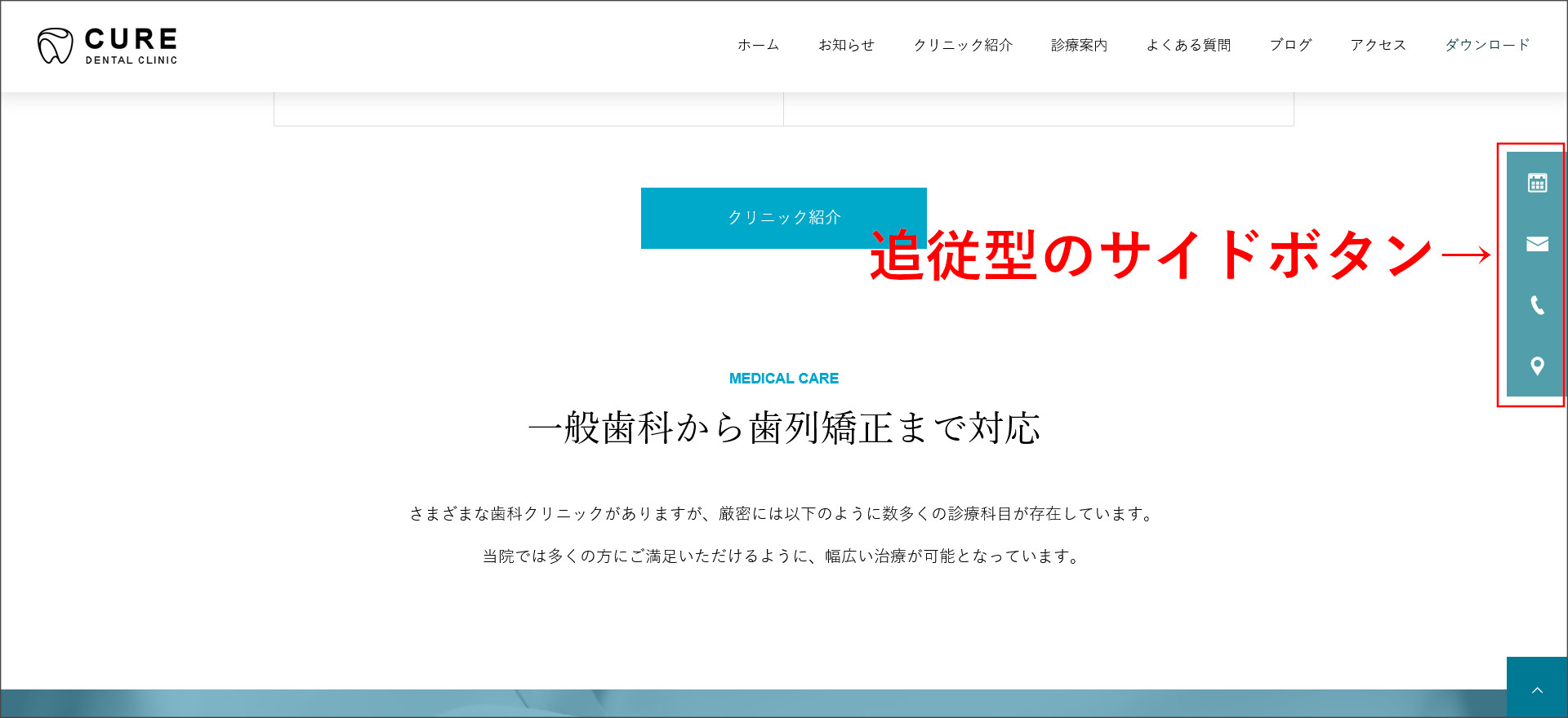 追従型のサイドボタン